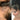 Woman with thinning hair showing scalp and hairline before and after using Moxi Loxi Growth Factors+ Peptide Hair Growth Serum